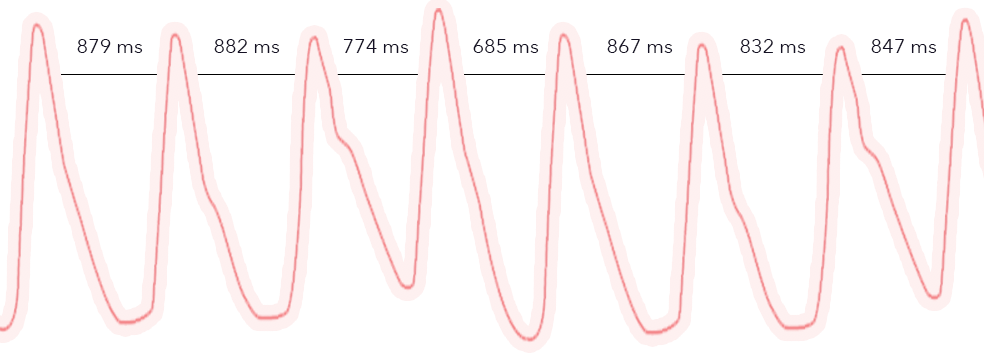 HRV from optical method