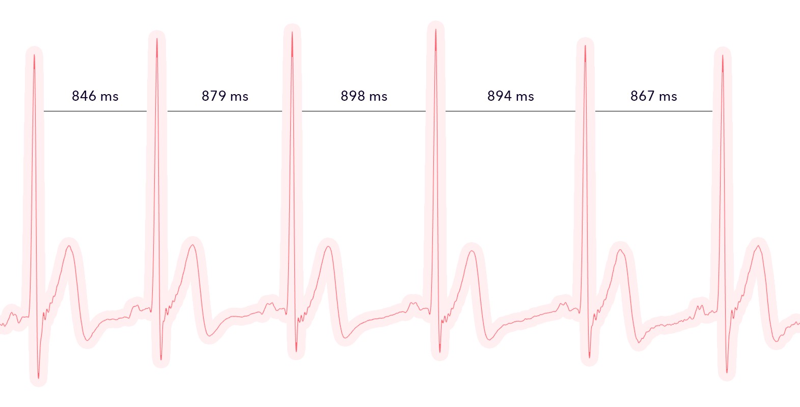 HRV from electrical signal