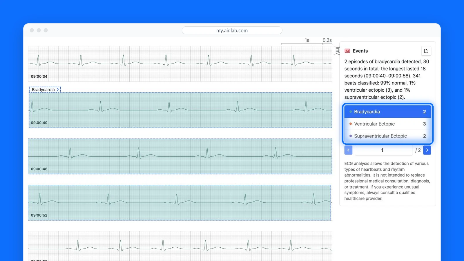 Aidlab dashboard with ECG events and a selected occurrence on the chart. Demo data.