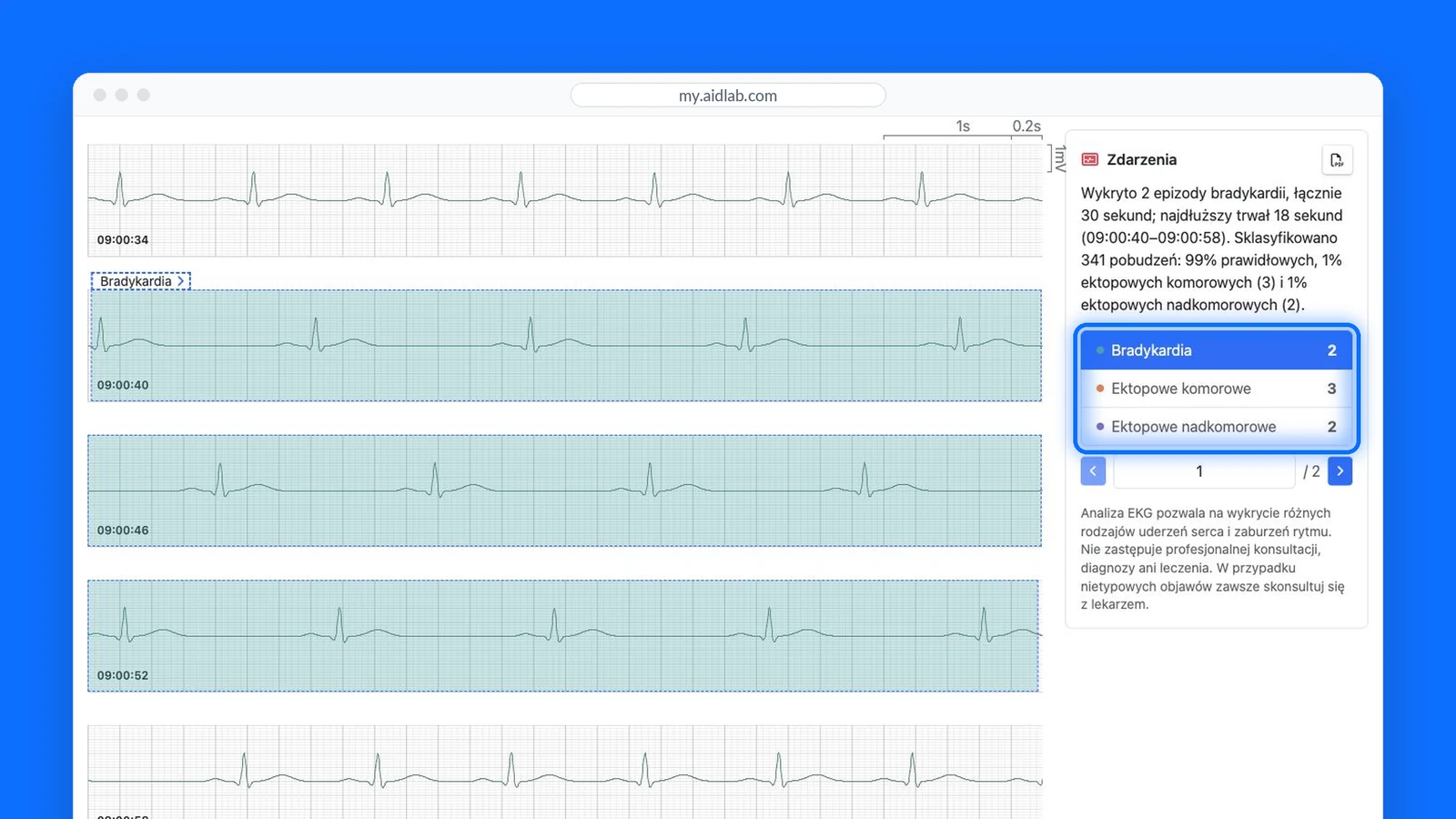 Dashboard Aidlab z listą zdarzeń EKG i wybranym wystąpieniem na wykresie. Dane demonstracyjne.