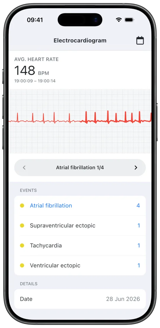 Aidlab app ECG report events screen