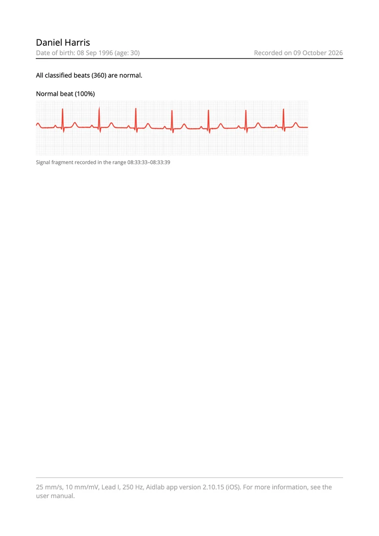 Przykładowy podgląd raportu PDF EKG z osią czasu