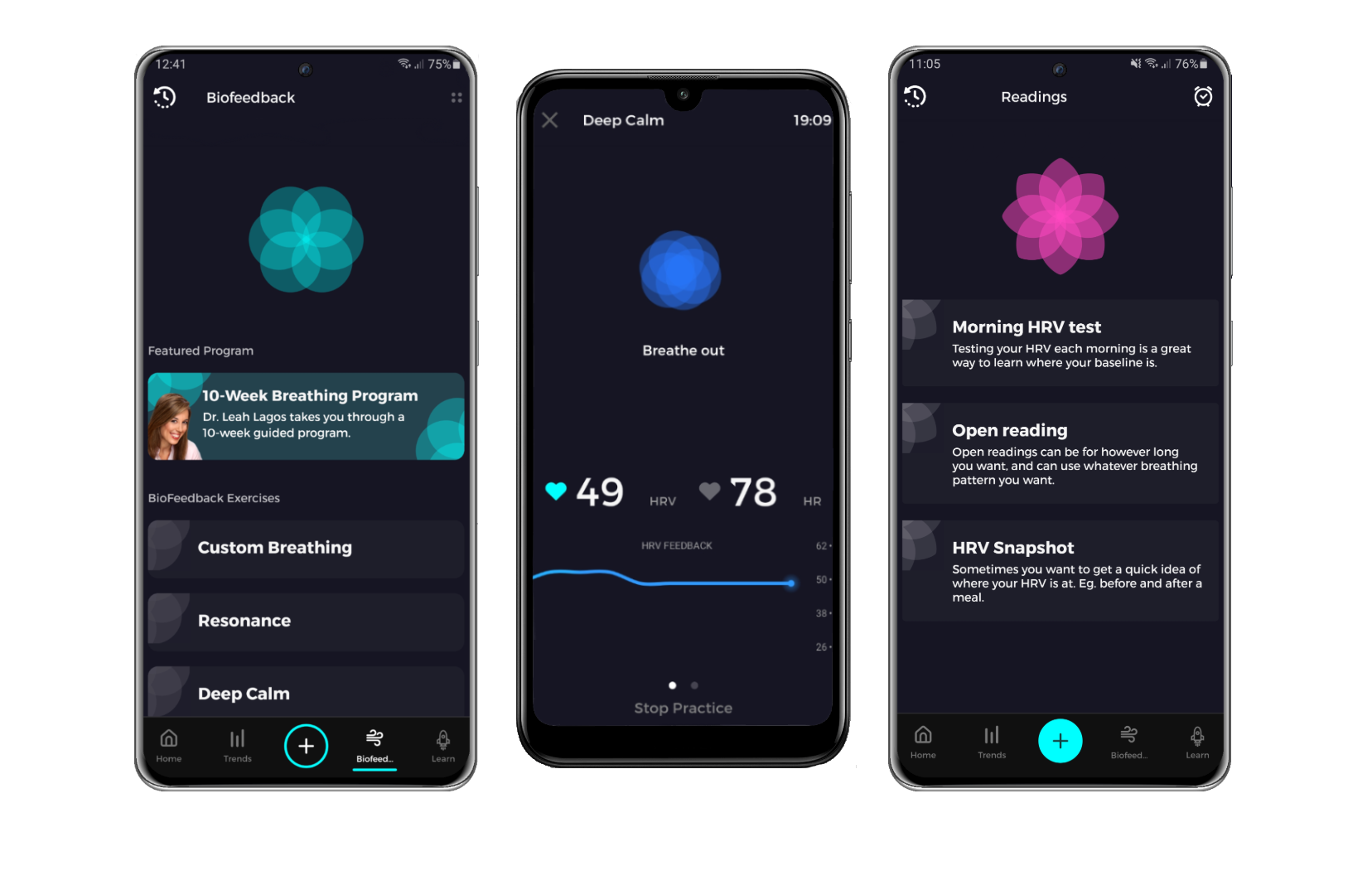 Different views of the Elite HRV app